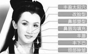 张磊通过这七步整容成了“赵雅芝”