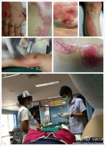 薛之谦车祸后微博报平安称手术顺利