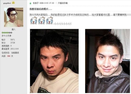 时尚毒舌gogoboi承认整容