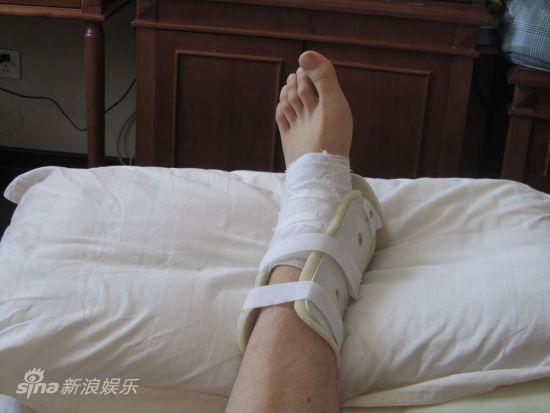 李易峰拍戏意外受伤 剧组照顾有加投保险(组图)