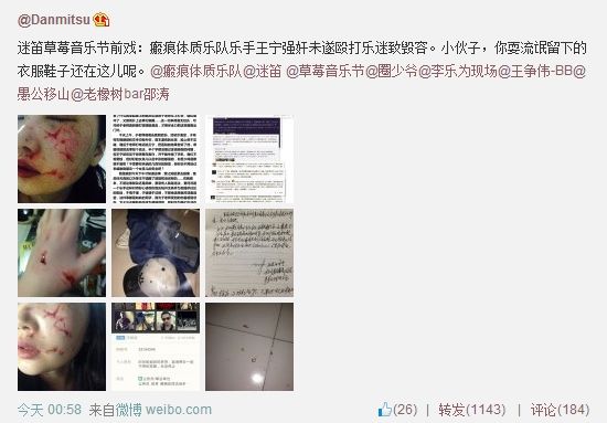 网曝摇滚乐手强奸未遂殴打女歌迷致毁容
