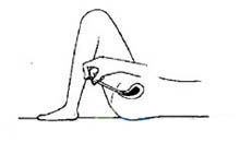 阴道塞药正确技巧