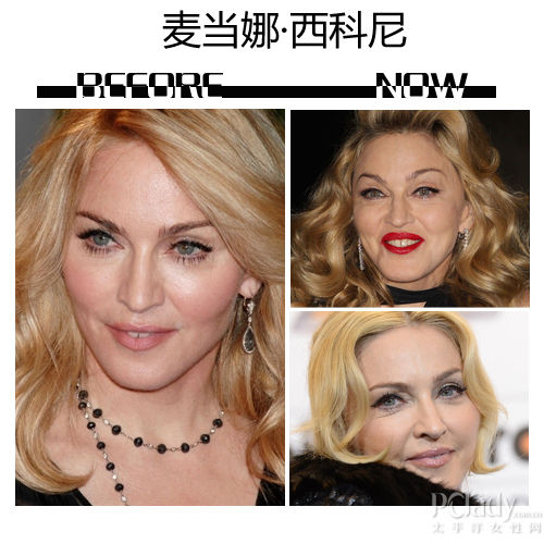 麦当娜-西科尼