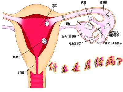 以下这些情况属月经病