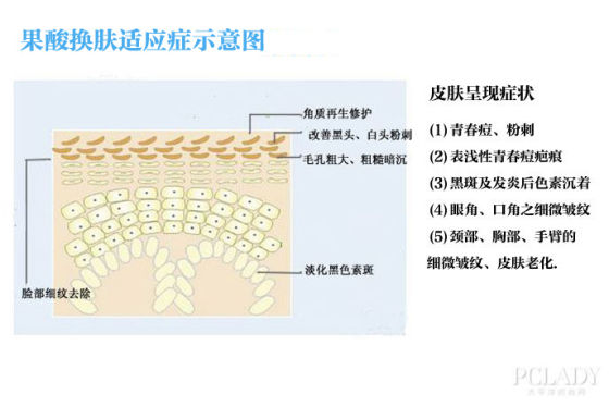 果酸换肤适用自检手册