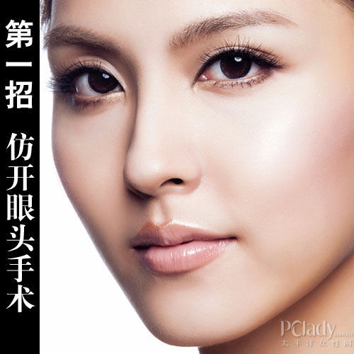 仿开眼头手术