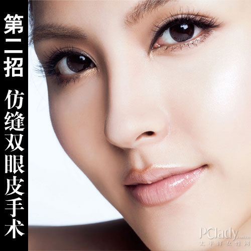 仿缝双眼皮手术