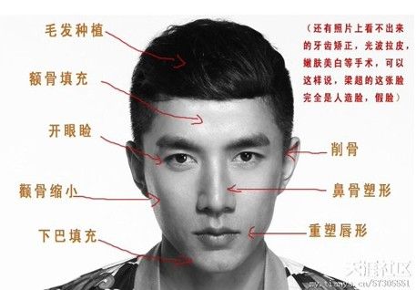 P头士梁超疑似整容前后对比照片