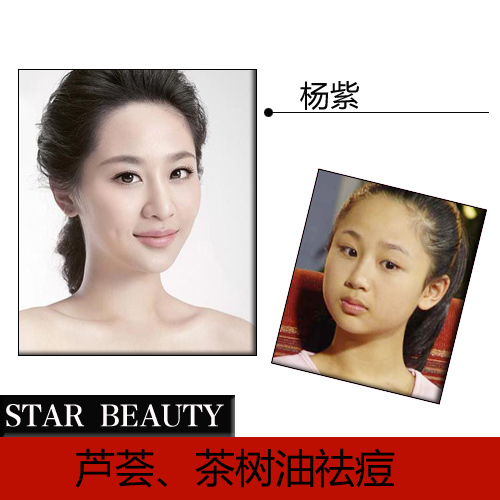 杨紫