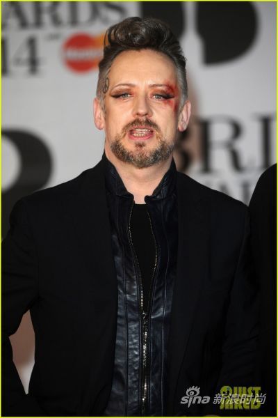 Boy George带着眼伤走上红毯