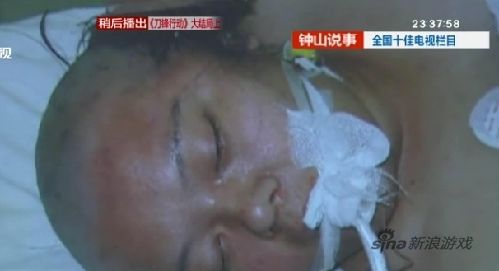 狠毒丈夫为骗巨额保险在妻子头上打钢钉