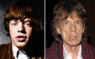 面部和颈部的衰老