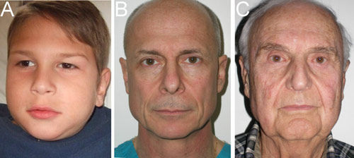 八岁、五十六岁、八十三岁幼年和老年脸形正好倒置