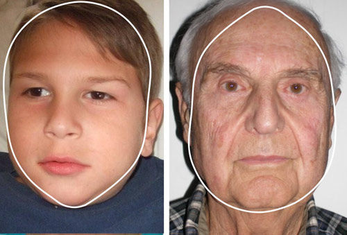 幼年和老年脸形正好倒置