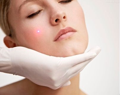 揭秘e光祛斑方法