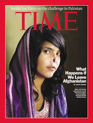 “割鼻女孩”爱莎上时代杂志。