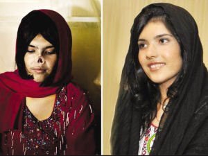 爱莎戴上了仿生鼻子，但是它脱带起来很麻烦。