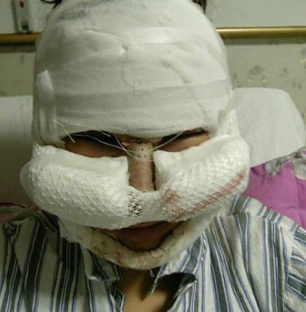 猜猜看，她都做了哪些手术。