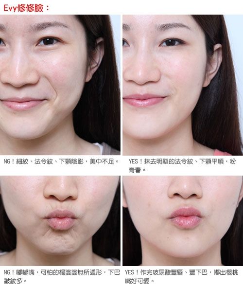 修脸前后对比。