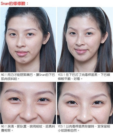 Snan修脸前后对比图