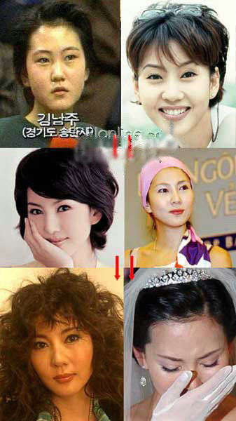 金南珠惊人变化