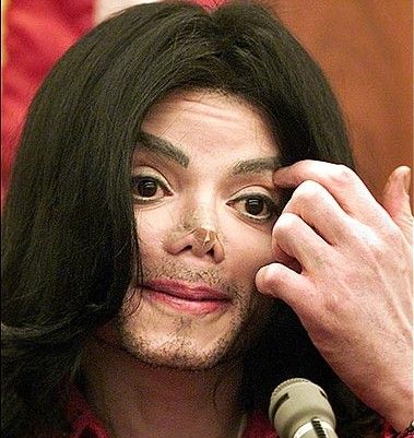 隆鼻失败的下场会这样。