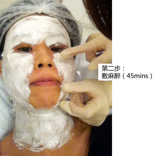 电波拉皮前，要先敷麻药。