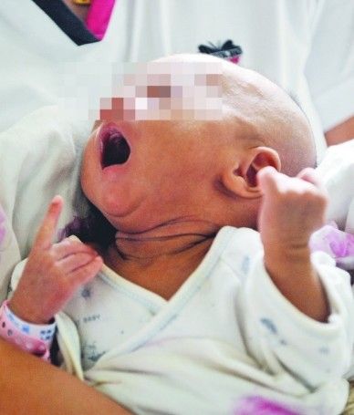 双性弃婴  吴胜摄