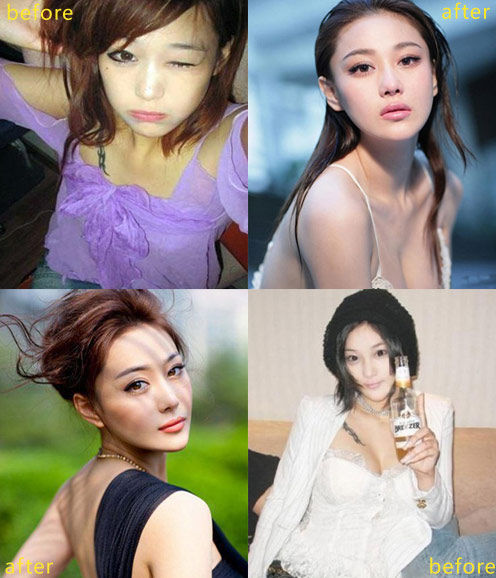 张馨予前后照片对比，否认整容。