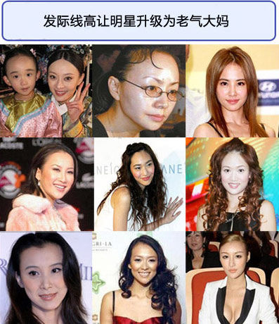 发际线过高的女星