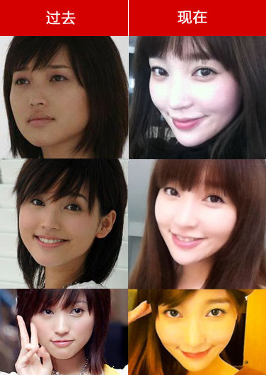 今昔相貌变化对比图