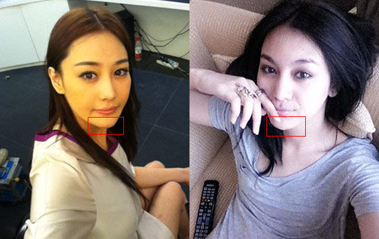 锥子脸在两位美人胚儿身上都很有标志性