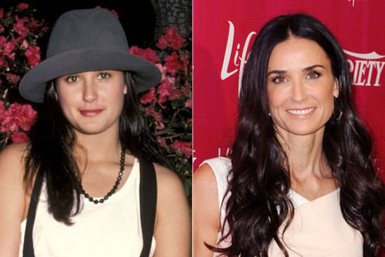 过分节食导致过早衰老