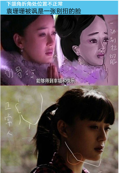 袁珊珊，腮骨也下移。