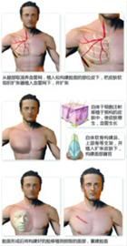 中国式换脸，手术示意图。