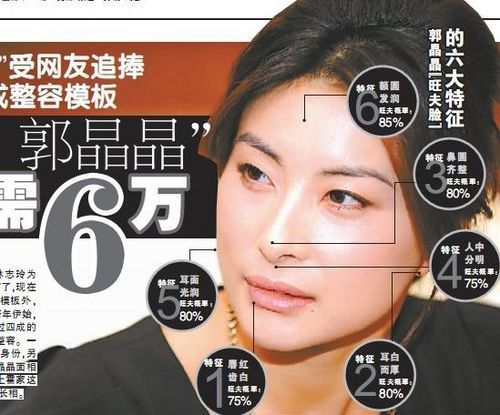 整形医生：整成郭晶晶至少需要6万。