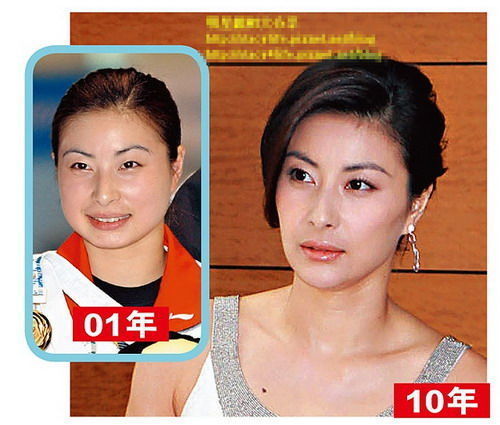 细心且八卦的网友翻出郭晶晶旧照做对比，看其是否整容过
