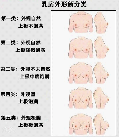 5种隆胸后乳房外形对比图