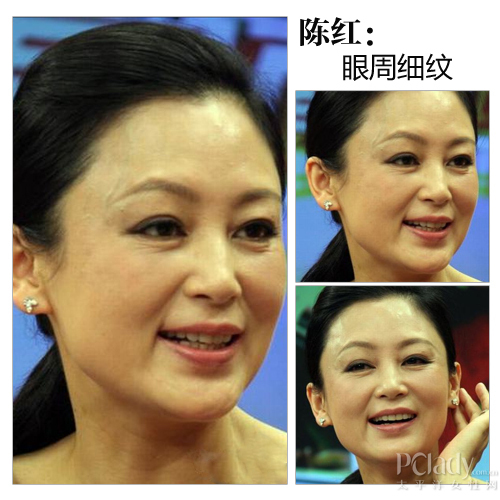 陈红眼周细纹显老态