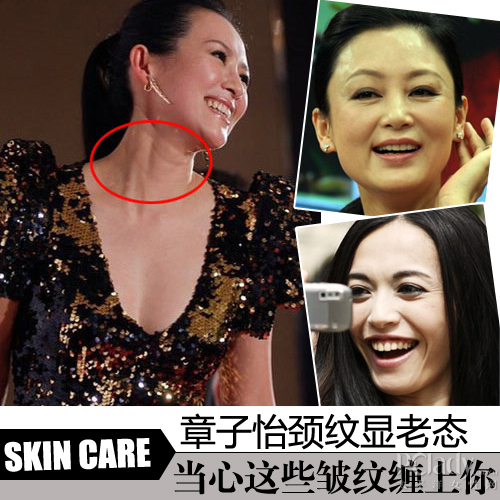 章子怡颈纹显老态 当心这些皱纹缠上你章子怡劲纹显老态