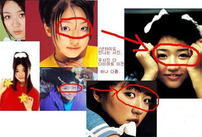 尹恩惠出道后做了双眼皮和鼻部整形