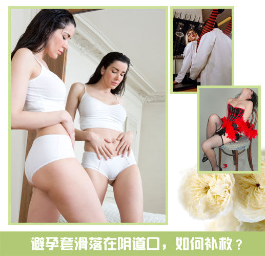 避孕套滑落在阴道口
