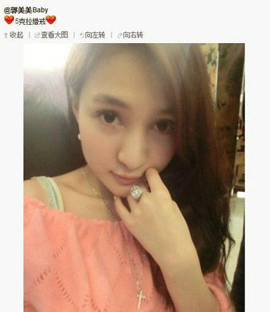 郭美美要隆鼻？