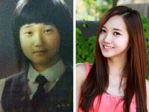 (韩国偶像组合Hello Venus刘雅拉整形前后对比照)