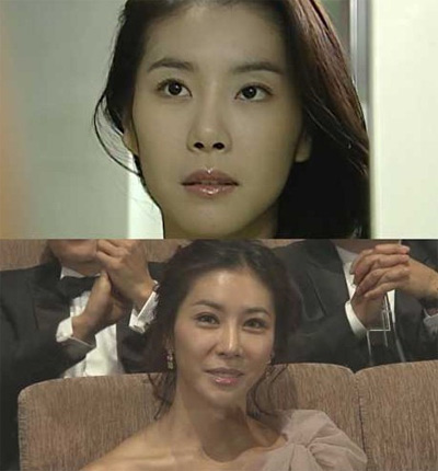 韩国女星韩恩贞脸部整容变残