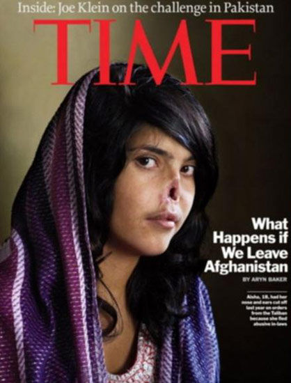 遭割鼻少女整容后重现美貌 