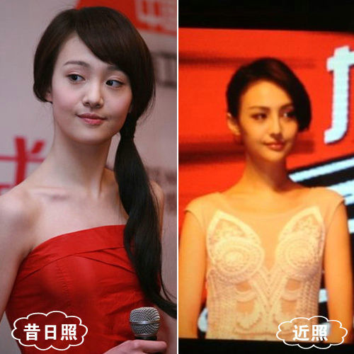 郑爽整容前后对比照