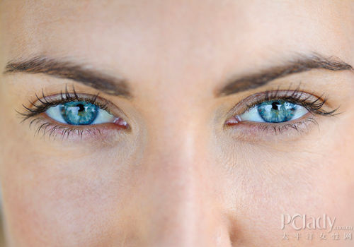 做双眼皮术先认清眼形
