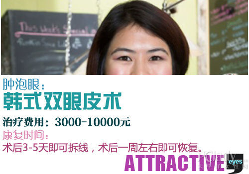 韩式双眼皮术