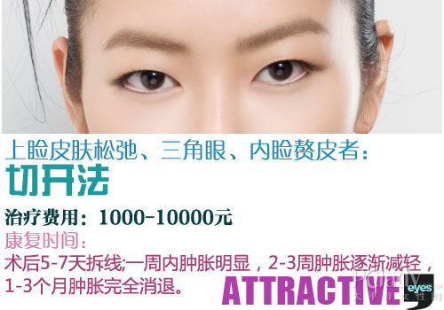 切开法双眼皮术